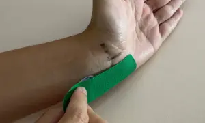 Hand mit grünen Tape, das auf das Handgelenk geklebt wird, um Taubheitsgefühl im kleinen Finger zu lindern.