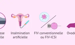 Illustrations de différentes méthodes pour concevoir un enfant, de la grossesse naturelle à l'ovodonation, utiles pour les femmes atteintes d'endométriose.