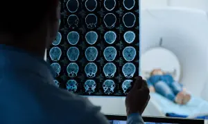 Lekarz analizuje wyniki rezonansu magnetycznego głowy bez kontrastu, szukając powikłań. W tle pacjent leży w aparacie MRI.