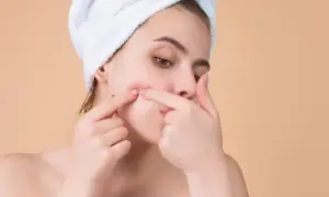 Dlaczego wyciskanie pryszczy jest przyjemne i co to oznacza dla ciebie