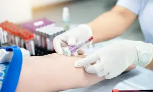 Pobieranie krwi do badań, w tym do oznaczenia poziomu **ige całkowite**. W tle stoją probówki.