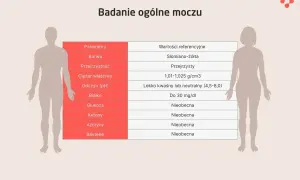 Tabela z badaniem ogólnym moczu, pokazująca parametry i wartości referencyjne. Azotyny w moczu powinny być nieobecne.