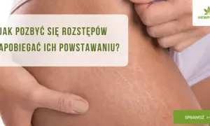 Jak Zapobiec Rozstępom? Skuteczne Metody i Pielęgnacja Skóry