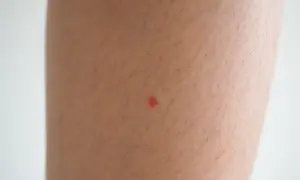 Una pequeña mancha roja en la pierna, quizás una picadura de insecto, resalta sobre la piel con vello.