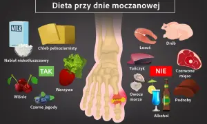 Dieta przy dnie moczanowej: zalecane nabiał, chleb pełnoziarnisty, warzywa, wiśnie, jagody. Unikaj czerwonego mięsa, podrobów, owoców morza, alkoholu. Leczenie wymaga zmian.