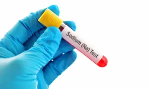 Mano con guanto blu tiene provetta con etichetta "Sodium (Na) Test", per verificare i sodio valori normali.