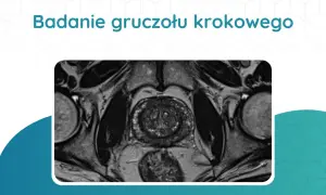 Tomografia prostaty: przekrój przez miednicę ukazujący gruczoł krokowy, pęcherz moczowy i inne struktury.
