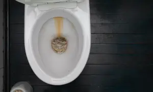Vergilbte Ränder in der Toilette zeigen, dass es Zeit ist, Urinstein zu entfernen. Hausmittel wie Essig oder Zitronensäure können helfen.