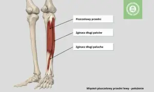 Ból goleni u biegaczy: Przyczyny, leczenie i jak biegać bez bólu?