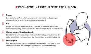Erste Hilfe bei Prellungen: PECH-Regel erklärt. Bei einer Prellung am Unterarm sofort Pause machen, Eis kühlen, Compression anlegen und den Arm hochlagern.
