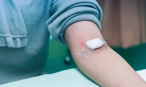 Ramię z wacikiem i plastrem po pobraniu krwi, czekając na wyniki badań.