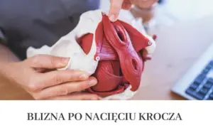 Jak dbać o krocze po porodzie: skuteczne sposoby na szybsze gojenie i komfort