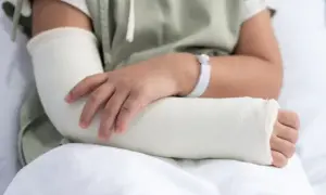 Złamanie łokcia ile gips – ile czasu musisz nosić gips?