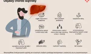 Ilustracja przedstawia objawy chorób wątroby, m.in. zmęczenie, ból w prawym podżebrzu, swędzenie skóry, nudności i wymioty. Wzw C może objawiać się podobnie.