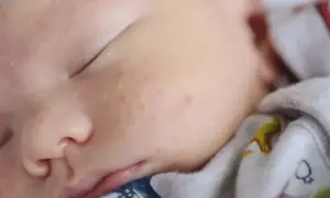 Czy seler uczula niemowlaki? Objawy i bezpieczeństwo w diecie dziecka
