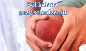 Dłonie obejmujące zaczerwienione kolano, symbolizujące ból kolana przy schodzeniu ze stromych tras.