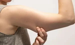 Mani che pizzicano la pelle per valutare le braccia flaccide, cercando rimedi della nonna per rassodare.