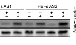 Western blot pokazujący poziom fosforylacji Smad1/5/9 w komórkach HBFs AS1 i AS2 po traktowaniu TGF-β₁ i ISL.