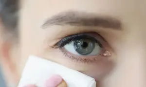 Delikatne łzawienie oczu, gdy chusteczka osusza kącik oka.