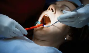 Dentysta bada jamę ustną pacjentki. Czy antybiotyk pomoże na ropień zęba?