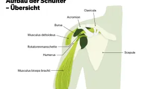 Schulteranatomie: Schulterblatt (Scapula), Oberarmknochen (Humerus), Schlüsselbein (Clavicula), Acromion, Bursa, Deltamuskel (Musculus deltoideus), Bizepssehne (Musculus biceps brachii) und Rotatorenmanschette. Der Levator scapulae ist hier nicht expli...