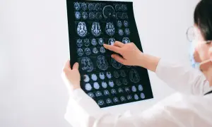Zarobki neurologa w Polsce: mediana, widełki i kluczowe czynniki