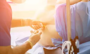 Un médico administra una epidural. Se discuten los posibles efectos secundarios de la epidural, como dolor de cabeza o entumecimiento.
