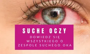 Czerwone, podrażnione oko. Tekst informuje o objawach zespołu suchego oka.