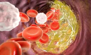 Czy cholesterol 250 to dużo? Normy, zagrożenia i jak go obniżyć