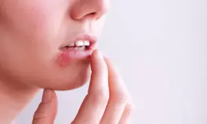 Z opryszczką do dentysty? Kiedy wizyta jest bezpieczna i co robić?