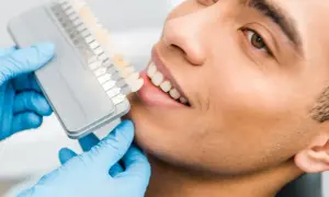 Dobór idealnego koloru licówek na jedynki. Dentysta w niebieskich rękawiczkach prezentuje wzornik odcieni.