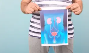 Mężczyzna trzyma wydruk z rysunkiem układu moczowego, pokazującym nerki, pęcherz moczowy i cewkę.