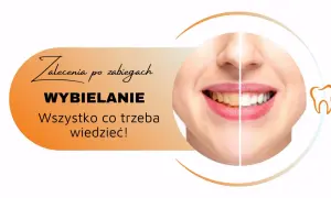 Zalecenia po zabiegach wybielania zębów. Uśmiech przed i po, by cieszyć się olśniewającą bielą.