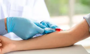 Badania krwi NFZ poza przychodnią? Jak i gdzie zrealizować skierowanie.