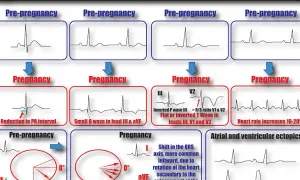 EKG w ciąży: kiedy jest konieczne i co musisz wiedzieć?