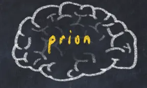 Szkic mózgu na tablicy, w środku żółty napis "priony".