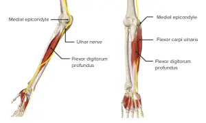 Anatomie des Arms: Nerven und Muskeln. Der Nervus ulnaris verläuft am medialen Epikondylus entlang und versorgt den Flexor digitorum profundus.