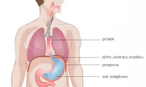 Kaszel refluksowy objawy – jak rozpoznać i uniknąć bólu gardła