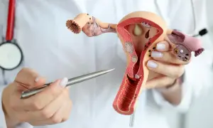 Model narządu rodnego kobiety z widocznymi zmianami sugerującymi **adenozyzę**. Lekarz wskazuje na nie długopisem.