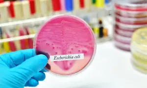 Ręka w niebieskiej rękawiczce trzyma szalkę Petriego z różowym podłożem, na którym widoczne są kolonie bakterii Escherichia coli.