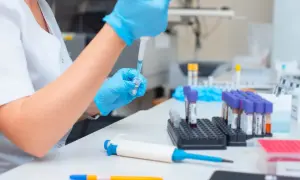 Laborantka w niebieskich rękawiczkach pobiera próbkę do analizy prokalcytoniny. W tle stoją probówki.