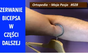 Ramię z wieszakiem zaczepionym o zgięcie bicepsa.