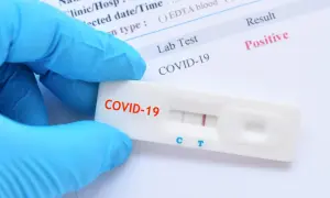 Ile czeka się na wynik testu COVID? Wszystko, co musisz wiedzieć.