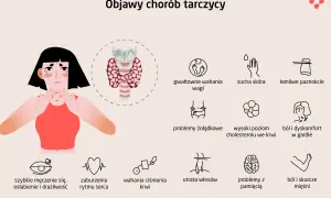 Ilustracja przedstawia objawy niedoczynności tarczycy: zmęczenie, problemy z wagą, suchą skórę, wypadanie włosów, bóle mięśni i problemy z pamięcią.