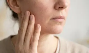 Nahaufnahme einer Frau, die ihre trockene Haut im Gesicht berührt. Die Haut schuppt und wirkt gerötet. Tipps zur trockene haut von innen behandeln.