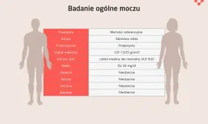 Tabela z parametrami i wartościami referencyjnymi badania ogólnego moczu, wskazująca prawidłowe wyniki.