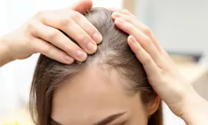 Manos revisando el cuero cabelludo, buscando soluciones sobre como evitar la caida del pelo.