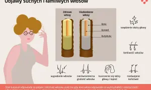Ilustracja pokazuje porównanie zdrowych i uszkodzonych włosów, podkreślając problem łamliwości.