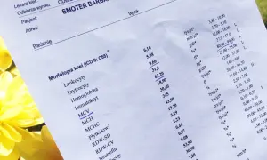 Badania krwi: Klucz do zdrowia? Zrozum swoje wyniki!