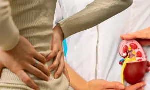 Ból pleców może być objawem odmiedniczkowego zapalenia nerek. Model nerki pokazuje jej budowę.